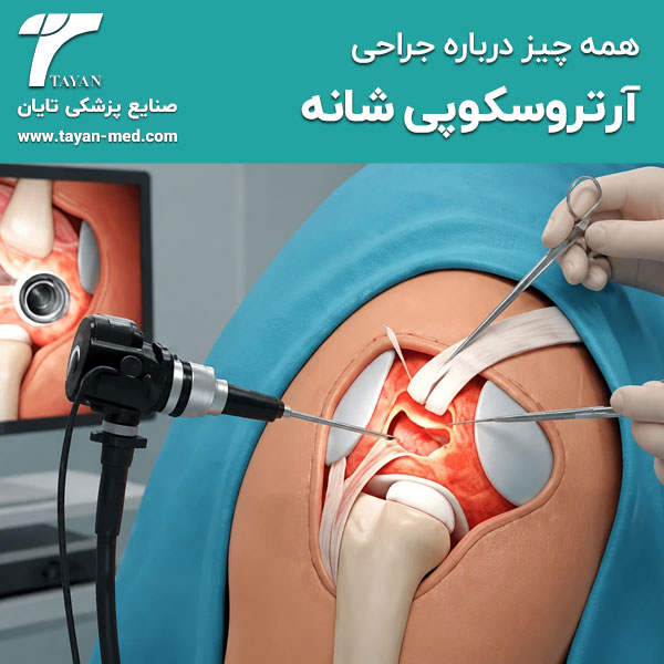 جراحی-آرتروسکوپی-شانه